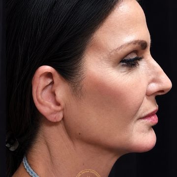 Full face