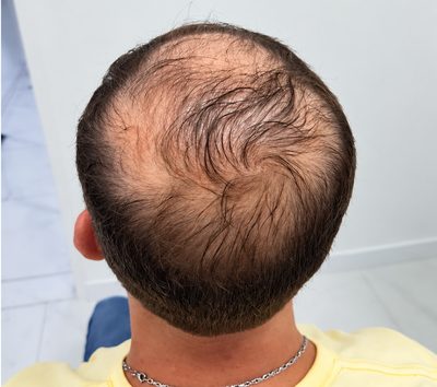 Tricologia